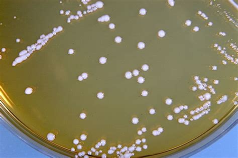 Adopt a Bacterium - Lactobacillus brevis | A Listly List