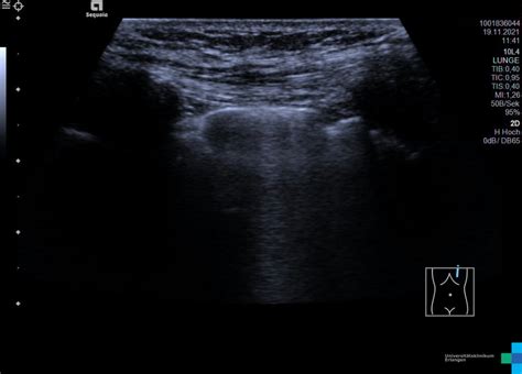 Normalbefunde Sonographieatlas Erlangen