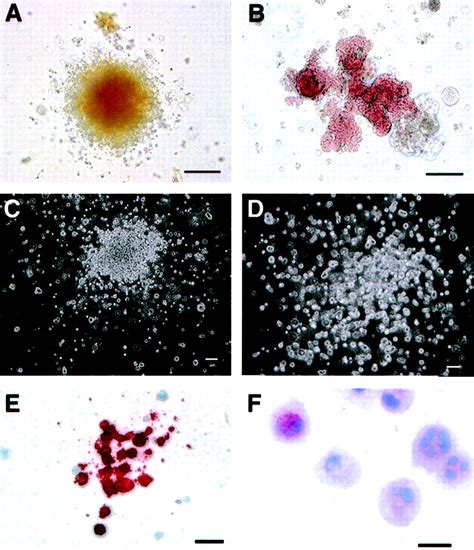 Hematopoietic Colony Forming Cells Derived From Human Embryonic Stem