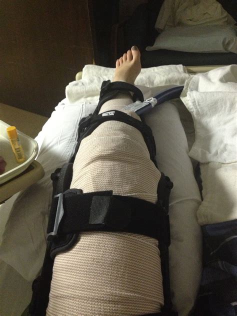 Icing Knee After Meniscus Surgery at Shaun Dorsey blog