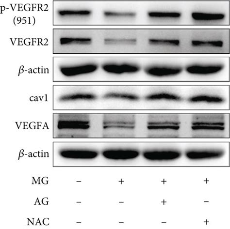 Effects of NAC or AG on the expression of AGEs/RAGE and angiogenesis... | Download Scientific ...