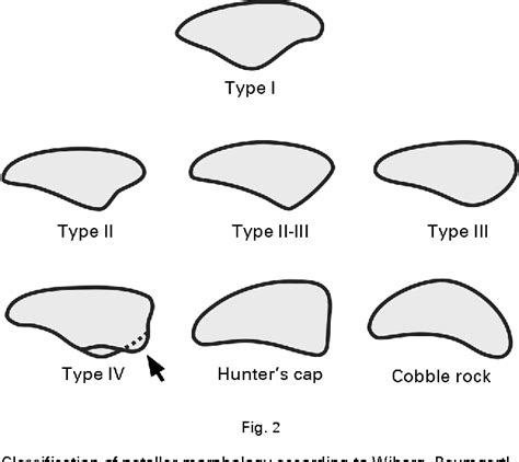 Figure 5 From Radiological Characteristics Of The Knee Joint In Nail