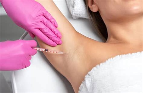 Excessive Sweating And Hyperhidrosis Treatment London On Beauty Within