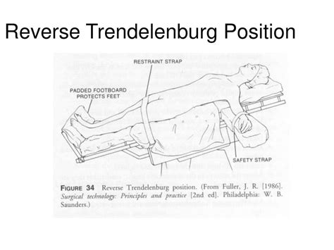 Reverse Trendelenburg Position