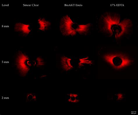 Figure 1 From Comparative Evaluation Of The Penetration Depth Into