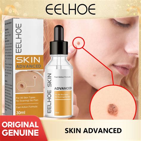 Eelhoe Wart Removal Serum Mole And Wart Essence Skin Face Armpit Meat