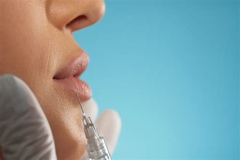 L Bios Saiba Tudo Sobre O Preenchimento Labial Dermatolaser