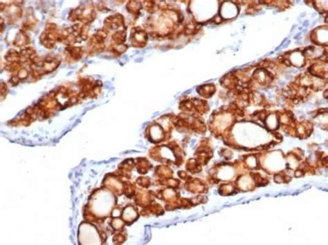 Thyroid Peroxidase Rabbit Anti Human Clone Tpo R Novus