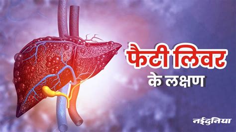 Health Tips शरीर में होने वाला दर्द हो सकता है फैटी लिवर इन लक्षणों