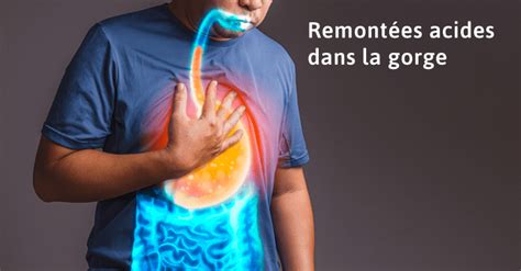 Remontées acides dans la gorge quelles solutions Reflux gastro