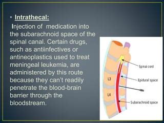 Epidural administration | PPT