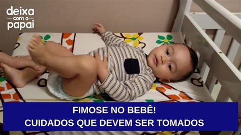 Fotos De Fimose Infantil Fdplearn