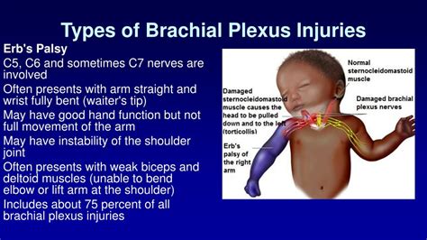 PPT - Brachial Plexus Injuries PowerPoint Presentation, free download ...