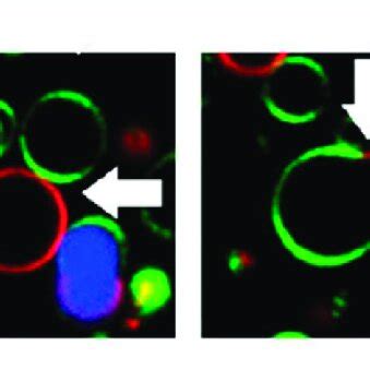 Confocal Fluorescence Microscopy Of Giant Unilamellar Vesicles Showing