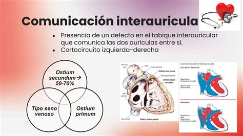 Cardiopatia Congenitas Clasificacion Presentacion Clinicas Y