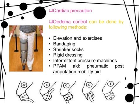 Amputationstump Care Phantom Limb Pain And Gait Training In Lower L