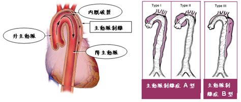 亞東醫院心臟血管外科