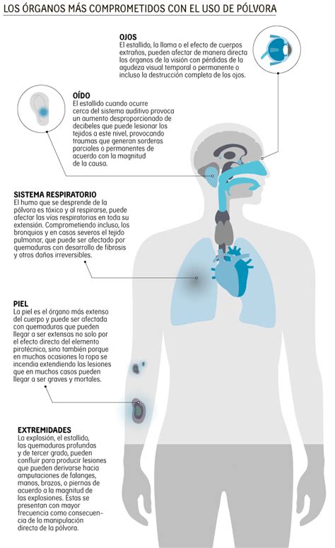 Infografia