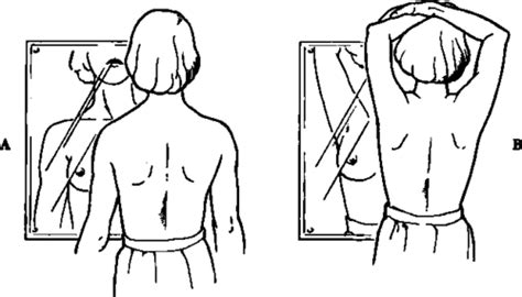 Physical Examination Of Breasts