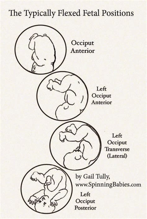 Flexion Matters - Spinning Babies