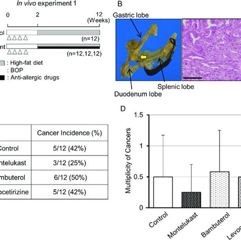 High Cysltr Expression Is Associated With Poor Prognosis In Pdac