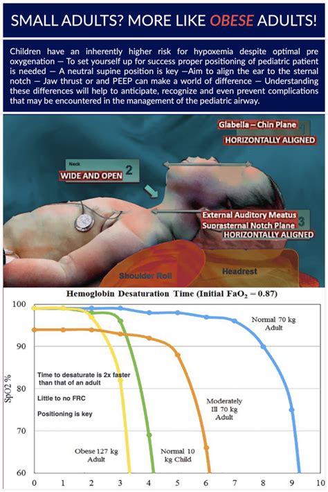 The Pediatric Airway The Protected Airway Collaborative