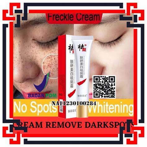 Jual Bpom Cindynal Niacinamide Skin Cream Pemutih Penghilang Flek Hitam