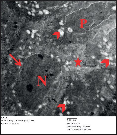 Photomicrographs Of Transmission Electron Micrograph Sections In The