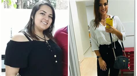 ANTES E DEPOIS PÓS BARIÁTRICA UM VÍDEO REPLETO DE FOTOS E MOMENTOS DA