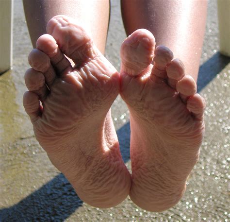 List 91 Pictures Why Is The Bottom Of My Foot Wrinkly Stunning