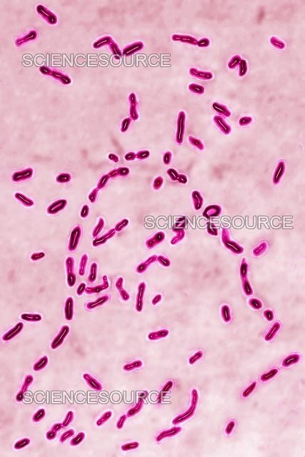 Bordetella Pertussis Lm Stock Image Science Source Images