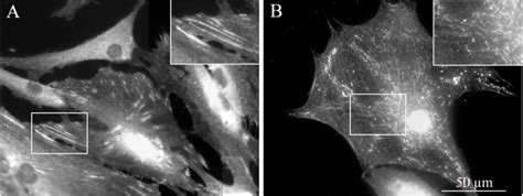 2. Super-mature adhesions are distinct from fibrillar adhesions (Biggs ...