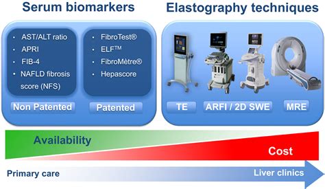 Non‐invasive Tests For Liver Fibrosis In Nafld Creating Pathways Between Primary Healthcare And