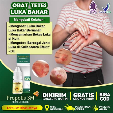 Jual Obat Luka Bakar Bernanah Bekas Luka Menonjol Luka Diabetes Luka