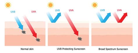 Ultraviolet Radiation Measurements: UVA, UVB, UVC