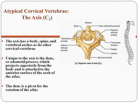 Atypical Cervical Vertebra