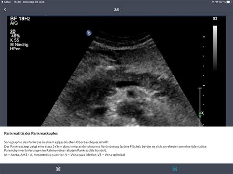 F Lle Innere Medizin Flashcards Quizlet