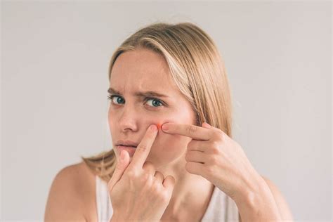 Blind Pimple How To Get Rid Of It Womensbyte