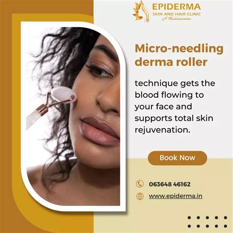 Ppt Microneedling For Acne Scars Best Skin Clinic In Jayanagar Epiderma Clinic Powerpoint