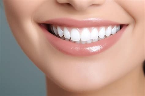 Perfecta Sonrisa De Dientes Sanos De Una Mujer Joven En Un Dentista Blanqueamiento Dental