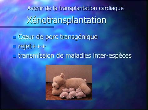 Ppt La Transplantation Cardiaque Powerpoint Presentation Free