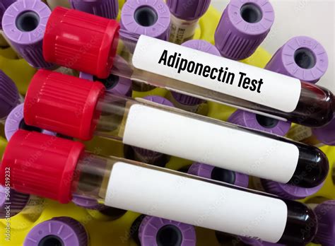 Blood Sample For Adiponectin Test Its A Protein Hormone And Adipokine