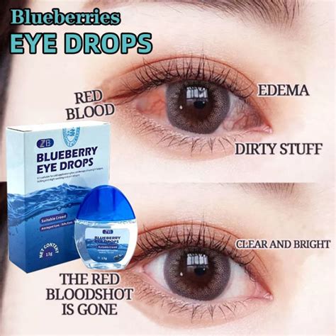 Original Blueberries Eye Drops For Clear Vision Dry Eyes Congestion