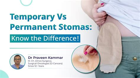 [stoma In Rectal Cancer] Temporary Vs Permanent Stoma Which Is Good