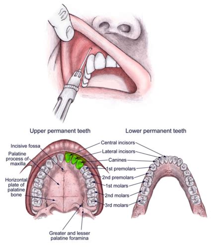 Local Anesthesia Landmarks Injections Flashcards Quizlet