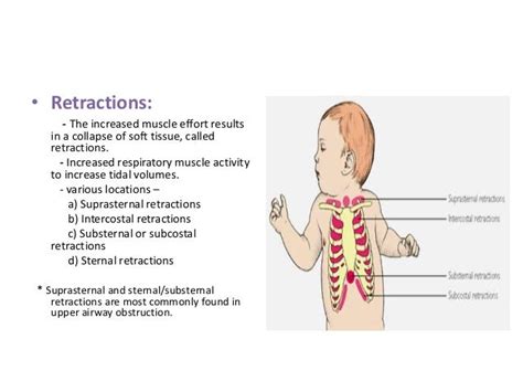 Respiratory Distress And Niv