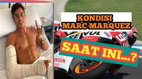 Setelah Operasi Ke Marc Marquez Diprediksi Akan Melewatkan Awal