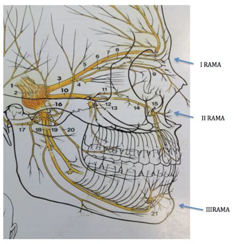 Nervio Trigémino ¿Qué es?, anatomía, función, ramas, enfermedades más