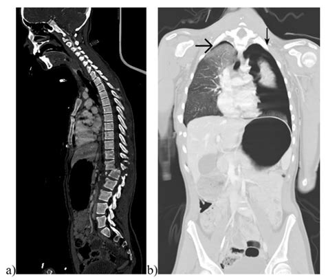 Diagnostics Free Full Text Whole Body Magnetic Resonance Tomography