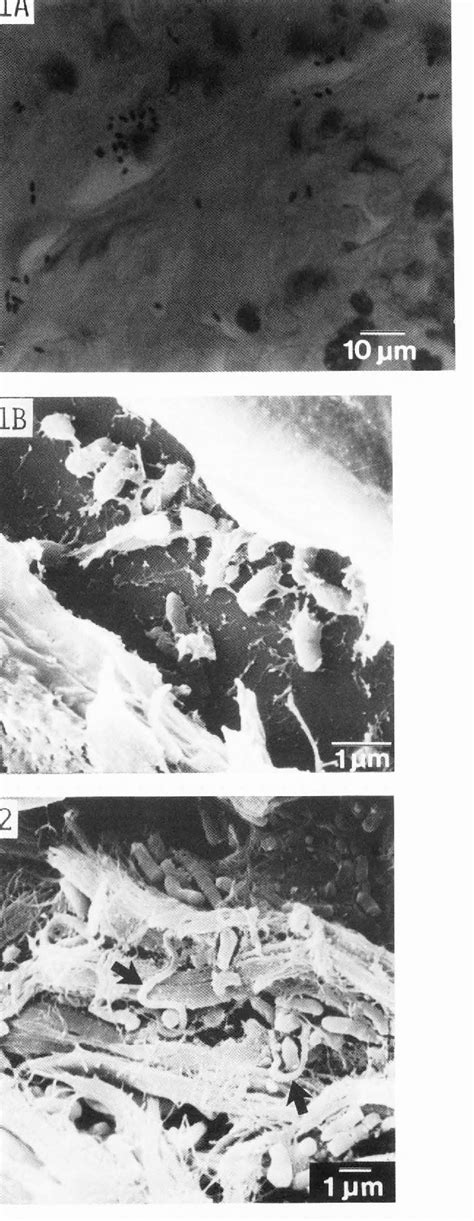 Figure 2 From Scanning Microscopy Scanning Microscopy Scanning Electron